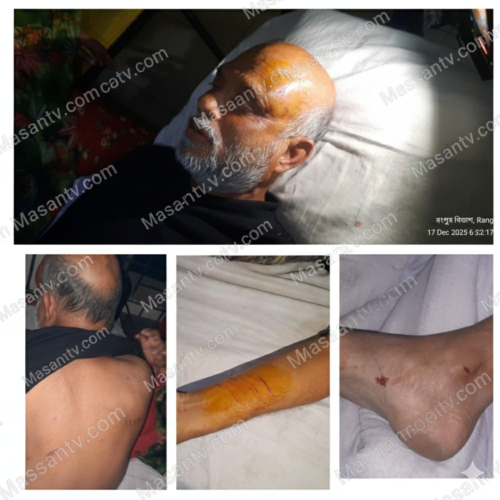 ভুরুঙ্গামারীতে জমি রক্ষায় ১৪৪ ধারায় মামলা করায় ভুমিদস্যুদের হামলা, জমির মালিক আহত