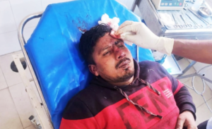 কচাকাটায় জমি দখলকে কেন্দ্র করে সংঘর্ষ: ছাত্রদল সভাপতিসহ উভয় পক্ষের ৪ আহত